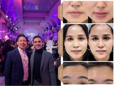 Perjalanan Seru Dr. Rudy di IMCAS 2025